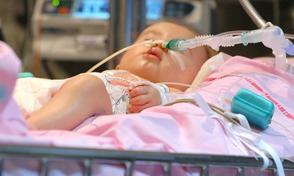 Picture of a newborn receiving ventilation