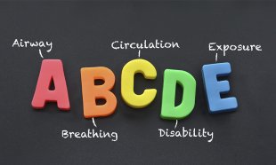 What is ABCDE and why is it important?