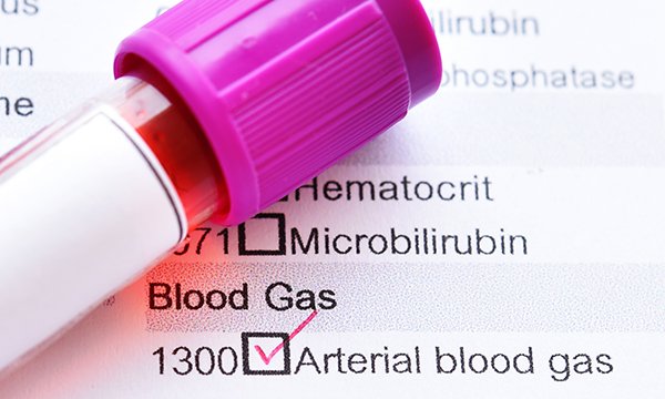 Analysing arterial blood gas results using the RoMe technique