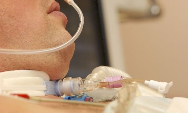 Caring for patients with a temporary tracheostomy